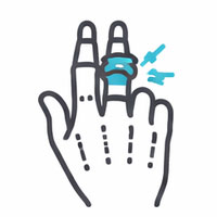 退化性關節炎icon