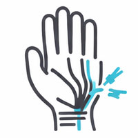 腕隧道症候群icon