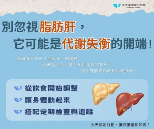 脂肪肝